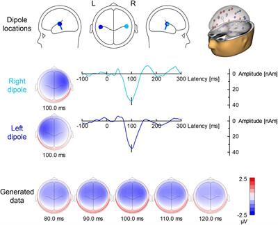 EEG-fMRI: Ballistocardiogram Artifact Reduction by Surrogate Method for Improved Source Localization